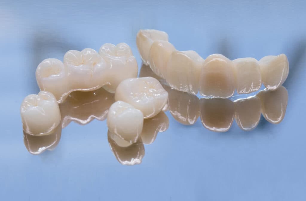 What Is Restorative Dentistry?
