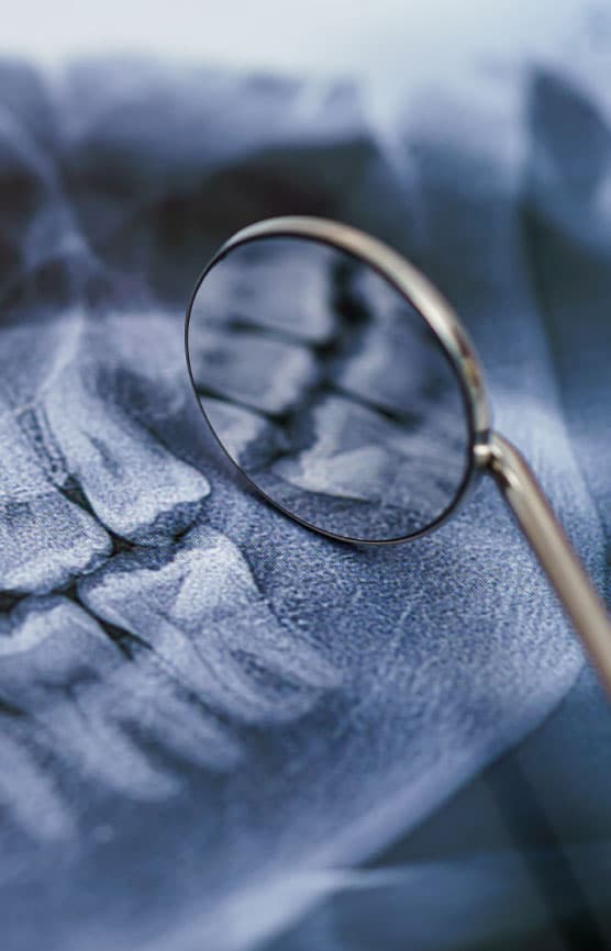 Dental Surgery