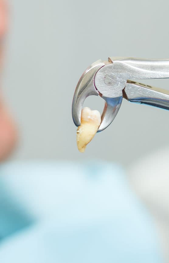 Extractions