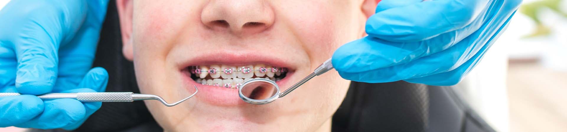 Orthodontics