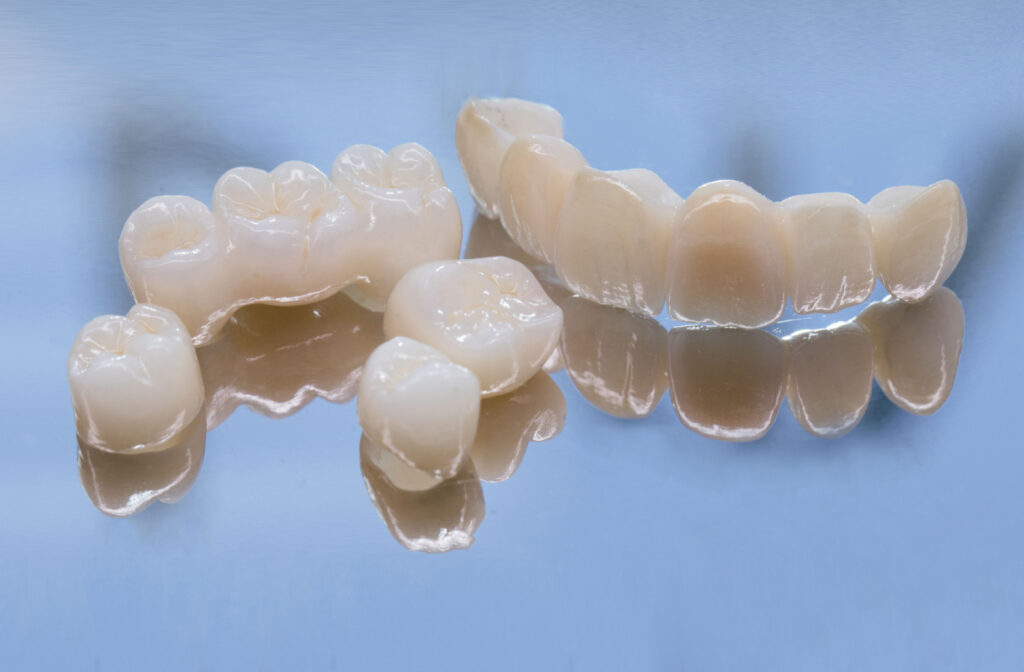 A set of ceramic dental bridges on a reflective surface.